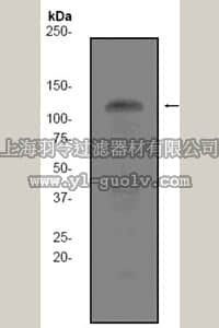 merck millipore,默克密理博,04-1160,Anti-KSR1 Antibody, clone EPR2421Y, rabbit monoclonal