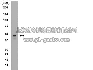 merck millipore,默克密理博,04-135,Anti-Brachyury Antibody, clone 3E4.2