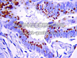 merck millipore,默克密理博,04-145,Anti-NOD2 Antibody, clone 2D9