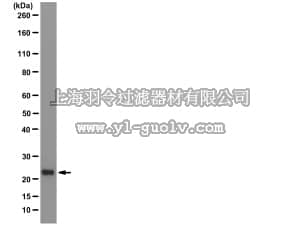 merck millipore,默克密理博,04-1464,Anti-Y14 Antibody, clone 1F12