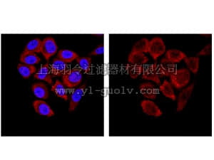 merck millipore,默克密理博,04-1466,Anti-SMN Antibody, clone 62E7