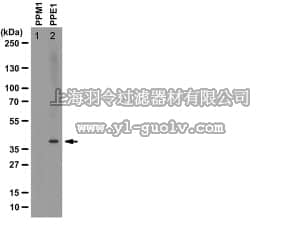 merck millipore,默克密理博,04-1479,Anti-methyl-PP2A Antibody, C subunit, clone 2A10
