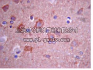 merck millipore,默克密理博,04-1526,Anti-Vitamin D receptor Antibody, clone 9A7