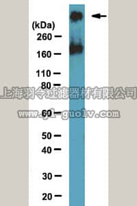 merck millipore,默克密理博,04-1551,Anti-SMRT Antibody, clone 1SM-1E7