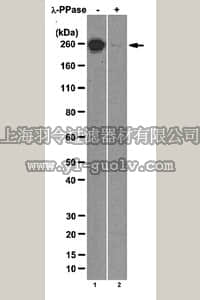 merck millipore,默克密理博,04-1570,Anti-RNA polymerase II subunit B1 (phospho-CTD Ser-7) Antibody, clone 4E12