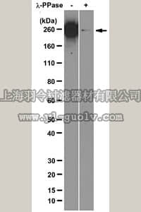 merck millipore,默克密理博,04-1571,Anti-RNA polymerase II subunit B1 (phospho CTD Ser-2) Antibody, clone 3E10