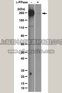 merck millipore,默克密理博,04-1572,Anti-RNA polymerase II subunit B1 (phospho-CTD Ser-5) Antibody, clone 3E8
