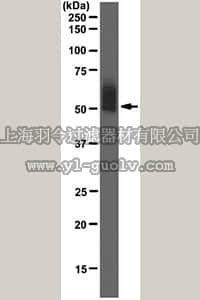 merck millipore,默克密理博,04-1581,Anti-IL-6R-alpha Antibody, clone 1C2