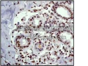 merck millipore,默克密理博,04-200,Anti-ATM Antibody, clone Y170, rabbit monoclonal