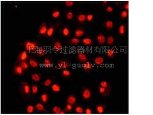 merck millipore,默克密理博,04-217,Anti-phospho-c-Myc (Thr58/Ser62) Antibody, rabbit monoclonal