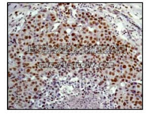 merck millipore,默克密理博,04-226,Anti-Elk1 Antibody, (CT), clone E277, rabbit monoclonal