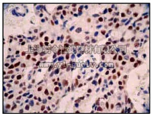 merck millipore,默克密理博,04-227,Anti-Estrogen Receptor α Antibody, clone E115, rabbit monoclonal