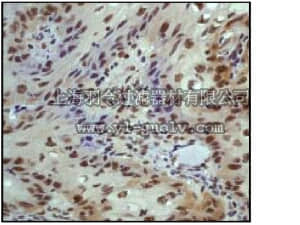 merck millipore,默克密理博,04-236,Anti-Nibrin/NBS1 Antibody, clone Y112, rabbit monoclonal
