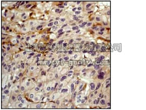 merck millipore,默克密理博,04-237,Anti-Catenin δ-1 (p120 Catenin) Antibody, cloneYE372, rabbit monoclonal