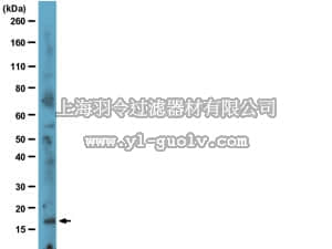 merck millipore,默克密理博,04-239,Anti-p16/INK4a Antibody, clone EP435Y, rabbit monoclonal