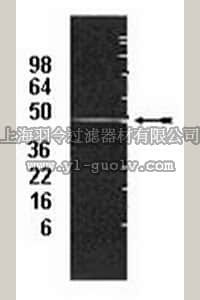 merck millipore,默克密理博,04-259,Anti-19S regulator non-ATPase subunit S5a/Rpn10 Antibody, clone S5a-18