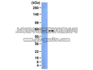 merck millipore,默克密理博,04-268,Anti-Lyn Antibody, clone 10A6.2