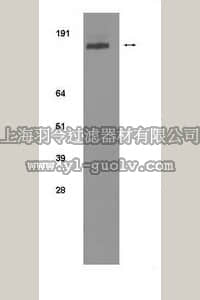 merck millipore,默克密理博,04-291,Anti-erbB2 (intracellular domain) Antibody, clone 24B5