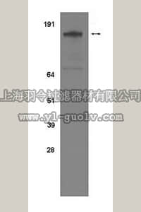 merck millipore,默克密理博,04-292,Anti-phosho-erbB2/Her2 (Ser1113) Antibody, clone 9E10