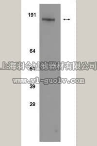 merck millipore,默克密理博,04-294,Anti-phosho-erbB2/Her2 (Tyr1112) Antibody, clone 19G5