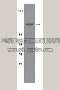 merck millipore,默克密理博,04-298,Anti-IGF1 Receptor (CT) Antibody, clone 7G11
