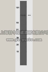 merck millipore,默克密理博,04-299,Anti-phospho-Insulin Receptor (Tyr 1150/1151) Antibody, clone 10C3