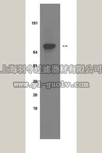 merck millipore,默克密理博,04-300,Anti-phospho-Insulin Receptor (Tyr 1322) Antibody, clone 21G12