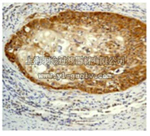 merck millipore,默克密理博,04-366,Anti-IKK beta Antibody, clone Y466, rabbit monoclonal