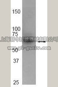 merck millipore,默克密理博,04-367,Anti-IRAK3 Antibody, rabbit monoclonal