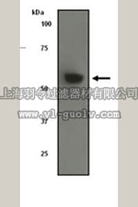 merck millipore,默克密理博,04-368,Anti-IRAK-4 (NT) Antibody, clone Y279, rabbit monoclonal