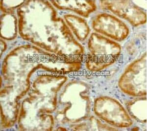merck millipore,默克密理博,04-369,Anti-IRR α subunit Antibody, rabbit monoclonal