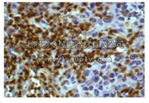 merck millipore,默克密理博,04-372,Anti-Lck/p56 Antibody, clone Y123, rabbit monoclonal