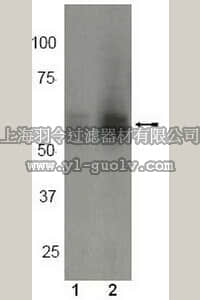 merck millipore,默克密理博,04-375,Anti-phospho-Lyn (Tyr507) Antibody, rabbit monoclonal