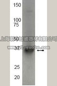 merck millipore,默克密理博,04-383,Anti-MKK6 NT Antibody, rabbit monoclonal