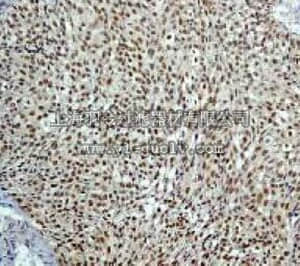 merck millipore,默克密理博,04-384,Anti-phospho-MSK1 (S376) Antibody, rabbit monoclonal