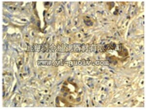 merck millipore,默克密理博,04-387,Anti-TBK1/NAK (NT) Antibody, clone EP611Y, rabbit monoclonal