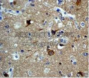 merck millipore,默克密理博,04-395,Anti-PAK3 Antibody, rabbit monoclonal