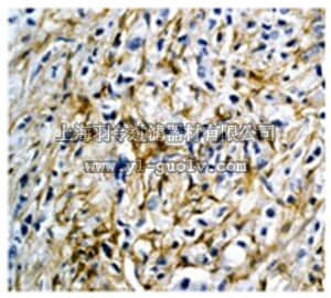 merck millipore,默克密理博,04-397,Anti-PDGF Receptor Beta (CT) Antibody, clone Y92, rabbit monoclonal