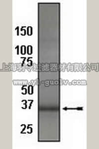merck millipore,默克密理博,04-435,Anti-Bcl-10 Antibody, rabbit monoclonal