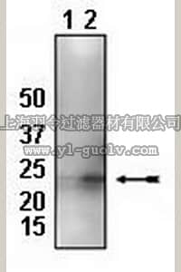 merck millipore,默克密理博,04-447,Anti-HSP27 Phospho (Ser78) Antibody, rabbit monoclonal