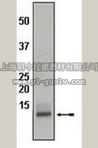 merck millipore,默克密理博,04-449,Anti-MIP-1 β/CCL4 (CT) Antibody, rabbit monoclonal