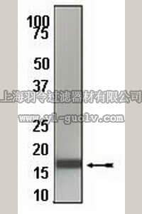 merck millipore,默克密理博,04-462,Anti-IL-1 β Antibody, rabbit monoclonal
