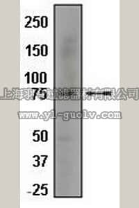 merck millipore,默克密理博,04-465,Anti-IL-1R1 Antibody, rabbit monoclonal