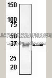 merck millipore,默克密理博,04-466,Anti-LAT Antibody, rabbit monoclonal