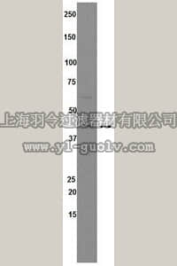 merck millipore,默克密理博,04-470,Anti-Farnesyltransferase Antibody, α subunit (FNTA), clone 2418