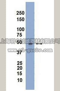 merck millipore,默克密理博,04-539,Anti-MAPKAP-K2 Antibody, clone 7H4.2