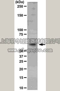 merck millipore,默克密理博,04-771,Anti-Akt2/PKBβ Antibody, clone AW114, rabbit monoclonal