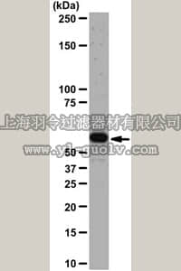 merck millipore,默克密理博,04-796,Anti-Akt1/PKBα Antibody, clone AW24,04-796