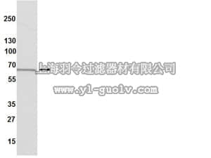 merck millipore,默克密理博,04-820,Anti-Estrogen Receptor α Antibody, clone 60C, rabbit monoclonal