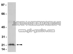 merck millipore,默克密理博,04-822,Anti-Rho (-A, -B, -C) Antibody, clone 3L74, rabbit monoclonal